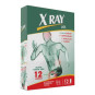 X RAY DOL CAJA X 12 TBL (ACETA-NAPRO-CAFEINA)